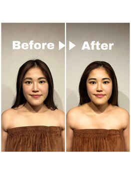 グレースフィオーレ 町田店(gracefiore)/ビフォーアフター/施術1回の効果