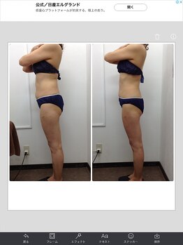 健康痩身研究所 名和店/ビフォーアフター