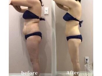 メゾン アンジュ(Maison Ange)/痩身コース/before&after