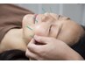 【美容鍼】 健康にキレイ、キメ肌 美肌 リフトUP 　