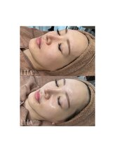 ピュアソル 奈良店(Puresol)/ララピール