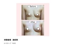 アップオー 天神大名店(up O)/