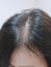 つむじや頭頂部のボリュームが気になる方のための頭皮ケア