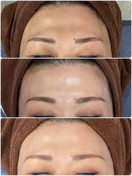 じぶんniプラス/常滑/フェイシャル/シミ/たるみ