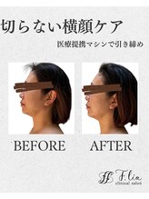 エフリア 大垣(F.lia)/ハ●フ超え！驚きの引き締め効果