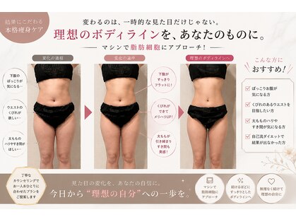 シェリール(CHIRIEUR)の写真