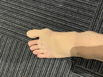 エスポアール(ESPOI'RE)/テーピング