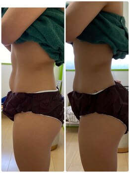 サロンドール(SalonDoll)/痩身