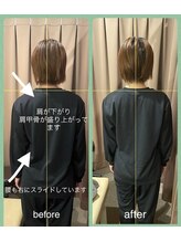 アイリー(Irie)/骨格矯正