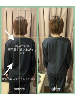 アイリー(Irie)/骨格矯正