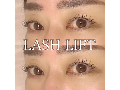 ルー(Lou)の写真