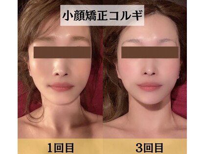 スイスパ(翠SUI SPA)の写真