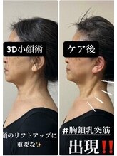 エトワール(etoile)/40代以降におススメ