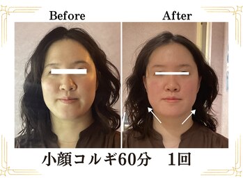 ベリール(BELIRE)/ベリールで本場韓国小顔コルギ！