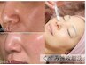 肌育ハーブピーリング【剥離なし】速攻美白/透明肌￥17,600→