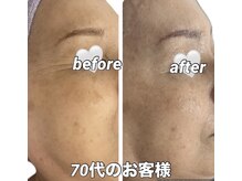 ヴィオレ パール(violet pale)の雰囲気（世界初に挑み続ける。それがリアボーテコレクションの本質です）