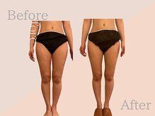 ファミーユ 名古屋店/【むくみケア】足のむくみケア