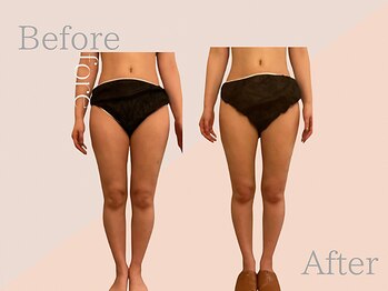 ファミーユ 名古屋店/【むくみケア】足のむくみケア