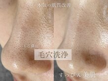 やさしく浮かせて毛穴すっきり