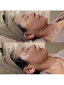 エステサロン マコ(MaCo)/50代・たるみケア