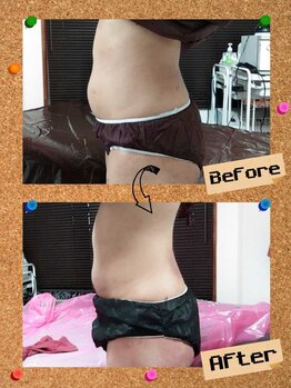 プチサロン ミニョンヌ(Petit Salon Mignonne)/ウエストくびれコース♪