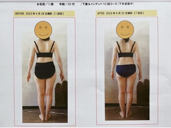 ソレイユ/インディバ 痩身