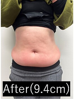 カナウ(kanau)/トリプルボディシェイプ