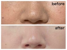 ダルセーニョ/【論より証拠！】３回目