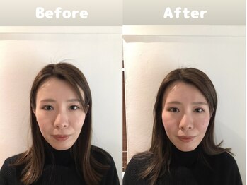 くにたちNyan鍼灸整体院/【小顔矯正】Before After 5