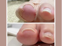 トゥーファイブ(nail studio to5.)の雰囲気（巻き爪ケアも可能！ジェルでの引き上げケアで見た目も◎）