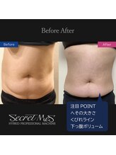 アディクト(Addict)/Before＆After