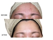 エングラッシー(en glassy)/BEFORE　AFTER　30代