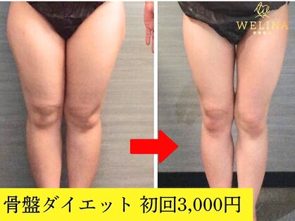 美容整体ウェリナ あま甚目寺院の写真