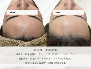 エメ(aimer)/SkinCare《肌管理・エイジング》