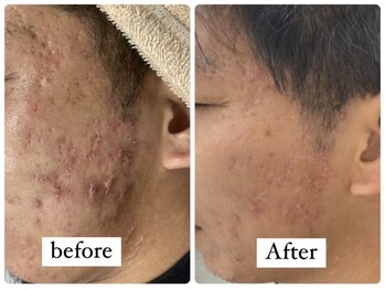 アルマサロン 菊陽(Almasalon)/【HAAB REPRO】ハーブリプロ