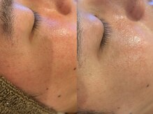 トトノエ(TOTONOE)/クリスティーナ-Forever Young-