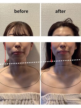 フォーリーフ(4 Leaf)/デコルテ美人は華奢見え効果☆