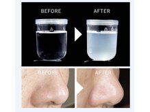 水素水で毛穴洗浄、頭皮洗浄