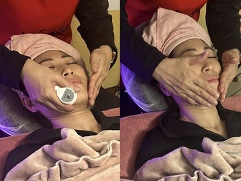 ヨサパーク ビウィズ(YOSAPARK 美 with)の写真/小顔/引き締め/引き上げ/毛穴/ほうれい線/むくみ/たるみ/乾燥/シミシワくすみの緩和・ケア◎美肌悩みに！