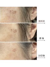 メディカルエース(MedicalAce)/スポット