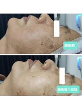 グランデ(Grande)/人気選べる光フォト