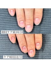 ネイルサロンアンドスクール マルベリー(mulberry)/江南市|自爪育成