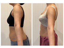 ソラ(sora)/バストアップしながら姿勢改善★