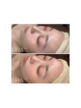 ピュアソル 奈良店(Puresol)/ララピール