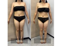 たかやなぎ整体院の雰囲気（全身痩身メニューの比較写真！）