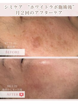 エクラ アン(eclat.un)/ホワイトラボ