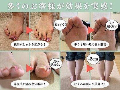 ピースの写真