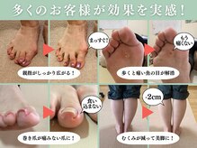 ピース