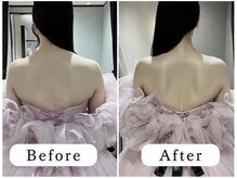 【ブライダルがダントツ人気】美容整体サロン哲のブライダル整体