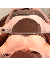 ビジョイ(Bejoy)/美アップバスト